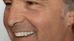 TruSmile Custom Made Veneers Demo