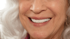 TruSmile Custom Made Veneers