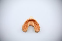 TruSmile Custom Made Veneers