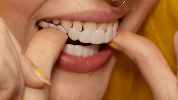 TruSmile Custom Made Veneers