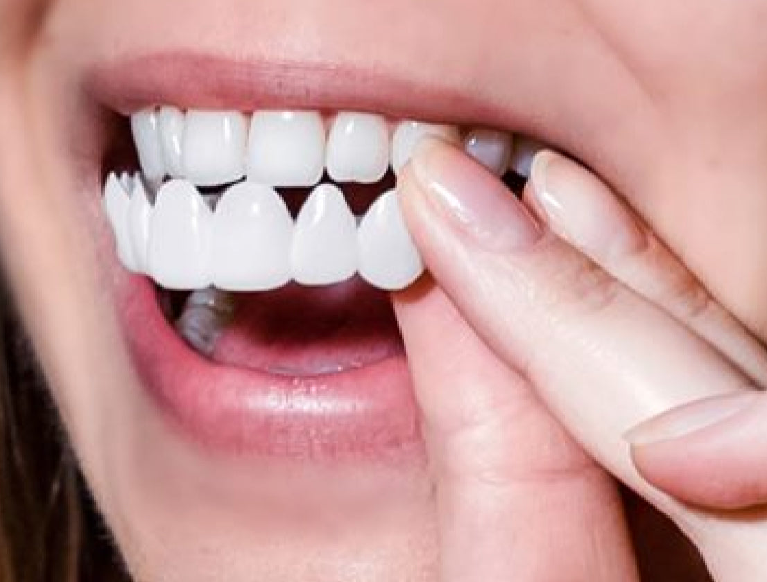 Enhance Your Smile Instantly with Snap-On Veneers Enhance Your Smile Instantly with Snap-On Veneers
