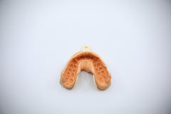 TruSmile Custom Made Veneers